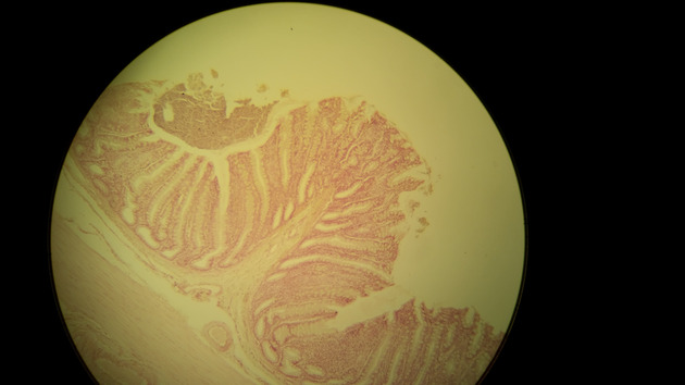 Colon Slides - Colon 005 100X